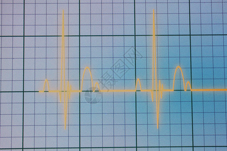蓝色背景的医疗心脏监测器ECGEKG心电图图片