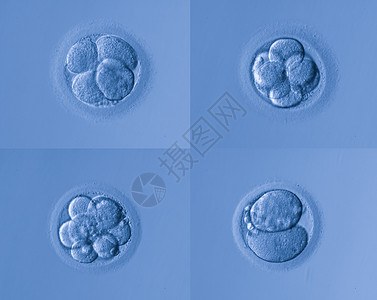 人工受精图片