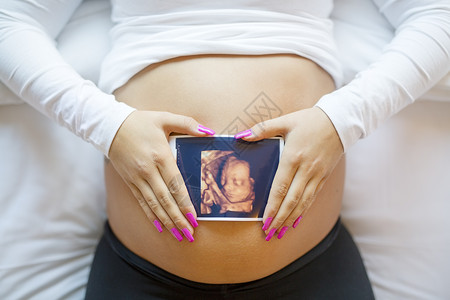 一名孕妇在裸露的腹部肿胀前拍下婴儿超声波照片图片
