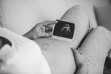 孕妇举行超声波扫描的特写黑白照片图片