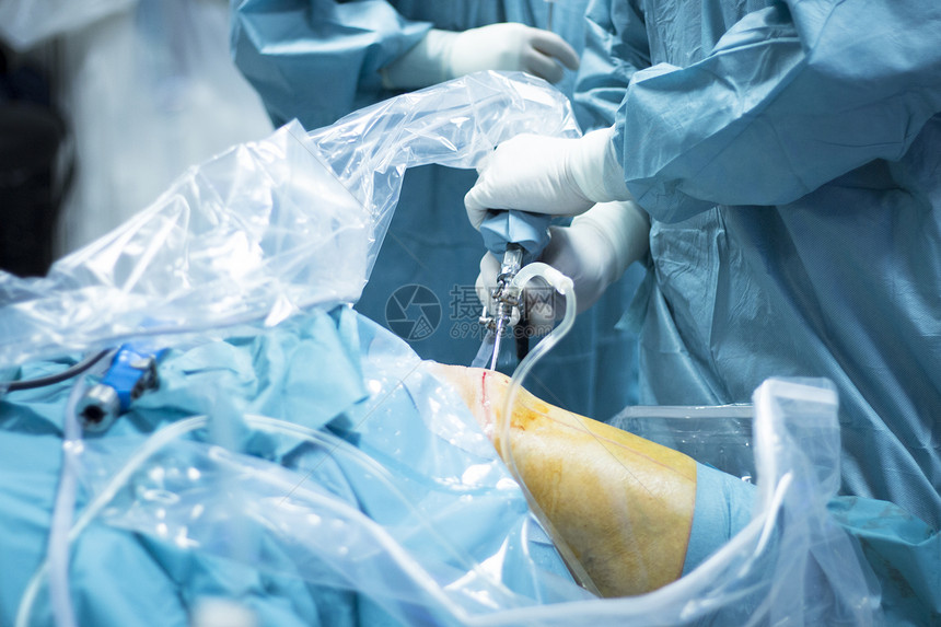医院手术室照片显示外科医生用关节镜相机和探头进行膝关图片