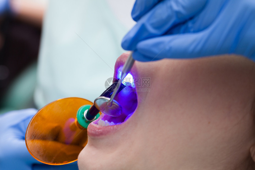 口腔牙科聚合灯的图片