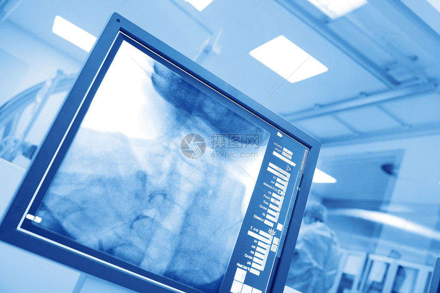监测医院cathlab的外科手术图片