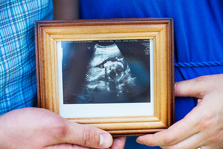 丈夫和他怀孕的妻子笑着看超声波怀孕照片图片
