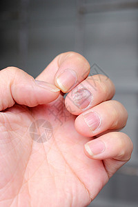 针头感染手指与结球病高清图片
