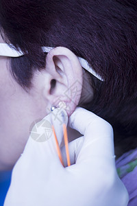 耳疗东方针灸耳籽贴膏药耳疗治理医院门诊理疗师图片
