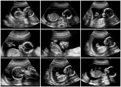 20周胎儿的9次超声系列图片