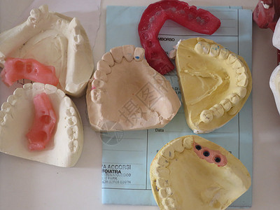 石膏印记门诊牙科假牙模具图片