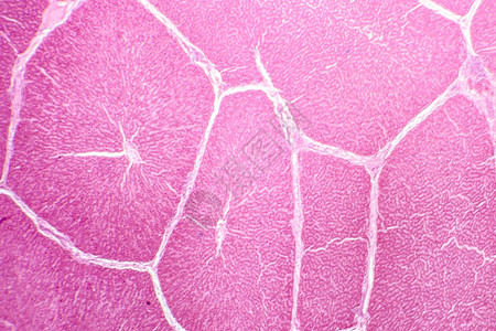 肝脏的光学显微照片显示了由肝细胞制成的条索和它们之间的清晰空间图片