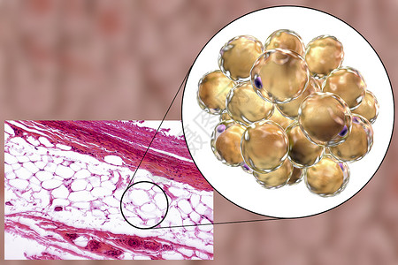 放大100倍脂肪细胞脂肪细胞有大的脂滴图片