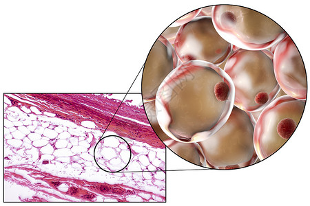 放大100倍脂肪细胞脂肪细胞有大的脂滴图片