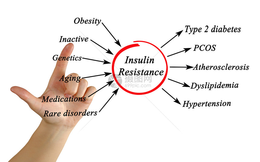 胰岛素抵抗图图片