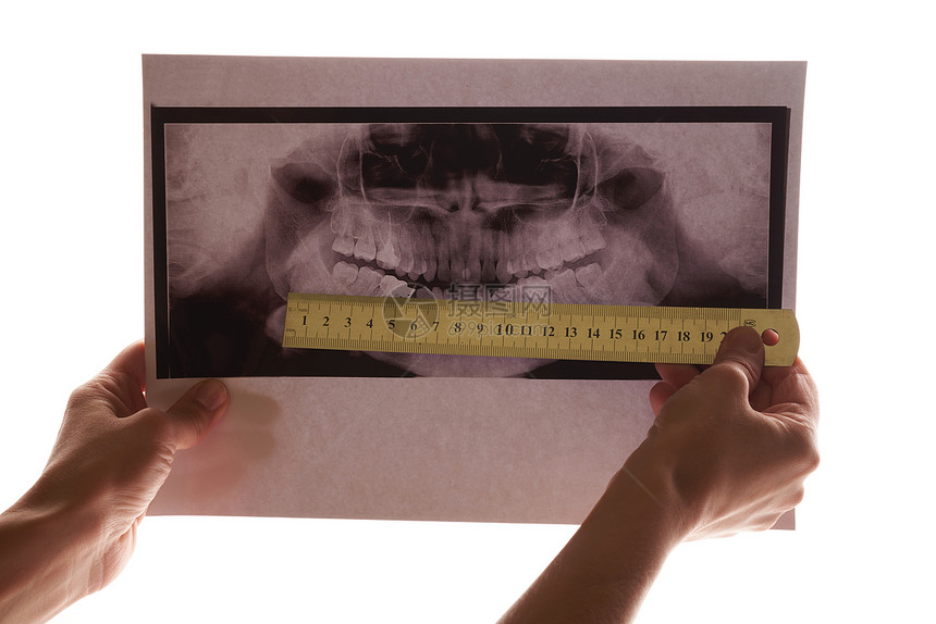 手持白色背景下颌骨和牙齿的X光片图片