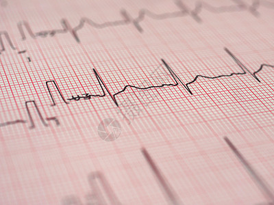 心电图ECG又名EKGElektrokardiogramm测量心跳背景图片