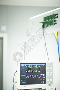 医院外科手术室急诊室的心电图显示图片