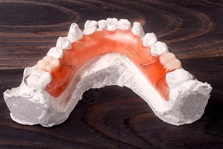 a牙膏石可移动部分假牙在黑图片