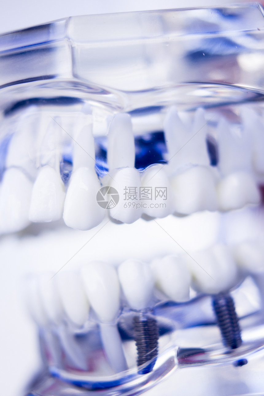 为教和牙科办公室显示牙齿和口香糖的病人安装螺丝植入器图片