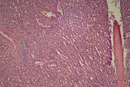 显微镜下的人类脾脏细胞有慢图片