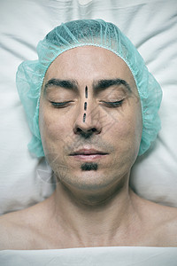 一个即将进行隆鼻手术的年轻白人男子头部的特写图片