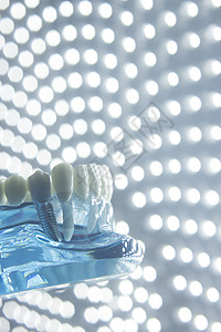牙医齿教学模型显示每颗牙齿牙龈牙根植入物腐烂牙图片