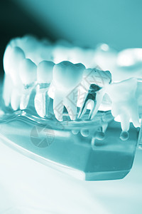 牙科医的牙齿模型显示牙凝胶口香糖根管运河石膏腐烂图片