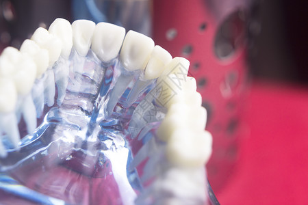 牙科医的牙齿模型显示牙凝胶口香糖根牌子腐烂图片