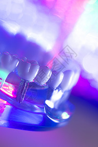 牙齿正畸牙科教学模型与牙龈牙釉质牙菌斑牙根背景图片