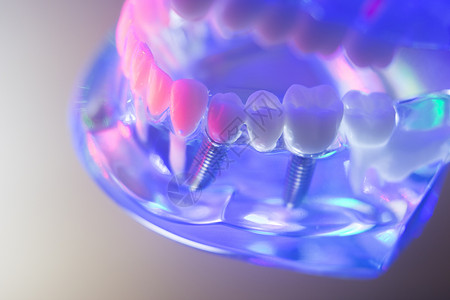 牙齿正畸牙科教学模型与牙龈牙釉质牙根图片