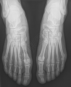 人体女脚骨X背景图片