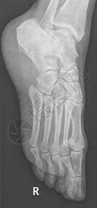 人体女脚骨X光射线辐射仪图片