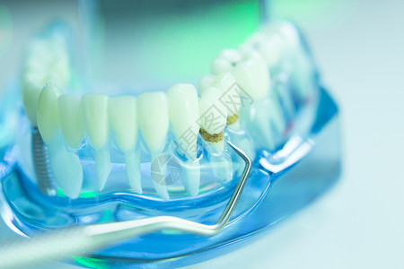 牙科口腔口香糖牙医教学模型显示每图片