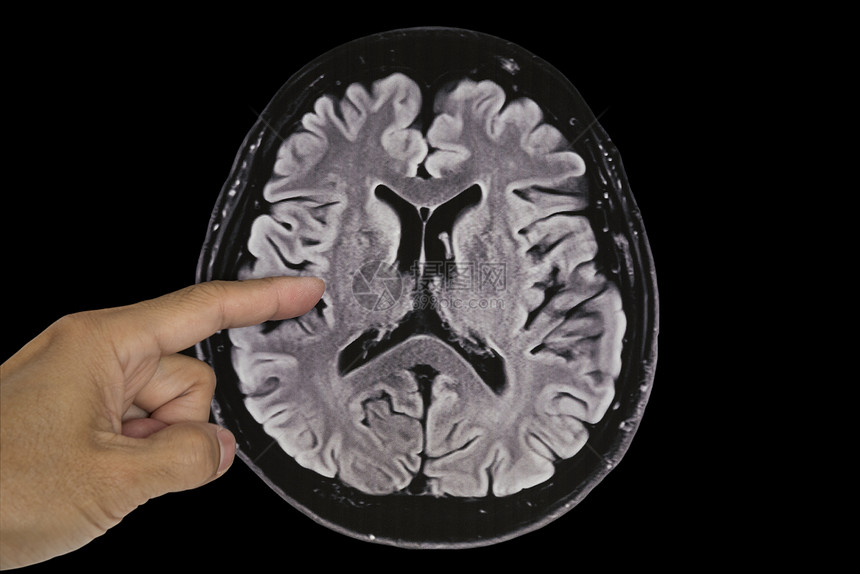 手指显示人类脑磁共振成像以轴视图和剪切图片
