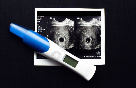 性腺怀孕测试背景上的对象背景