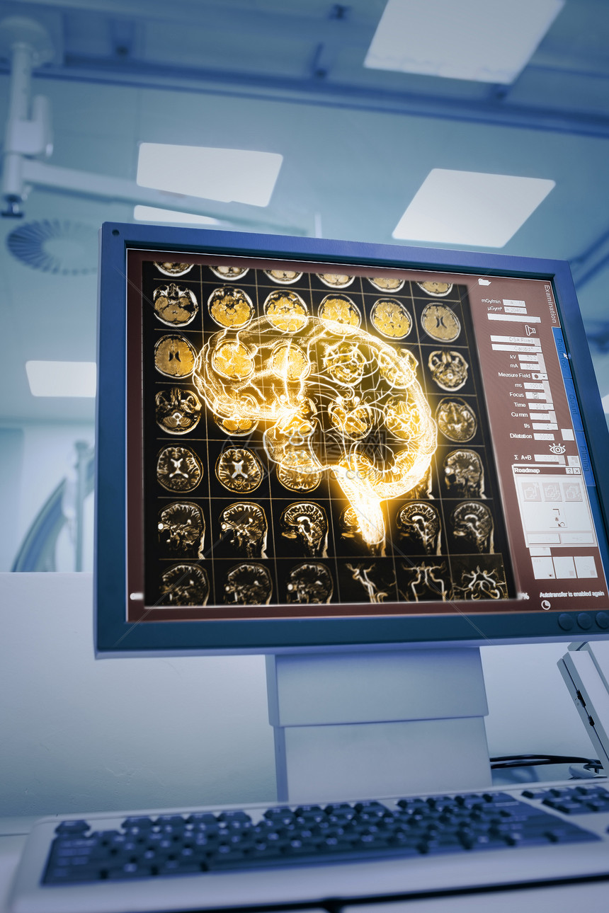 人体大脑CT投射在图片