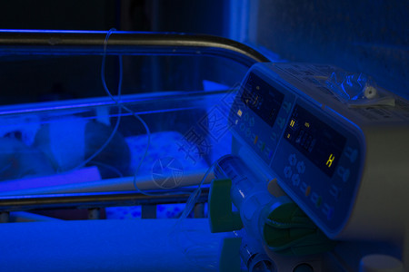 新生儿重症监护室婴儿加热器在蓝光紫外线下进行光疗婴儿在保温箱中的紫外线下治疗黄疸用于输图片