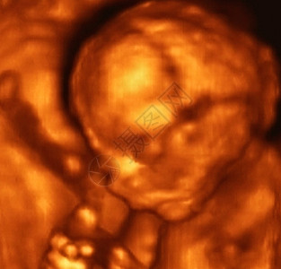 意大利第四月胎儿四月的图片