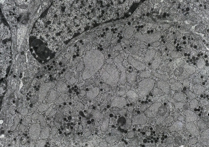 精细结构去势细胞细胞生物学高清图片