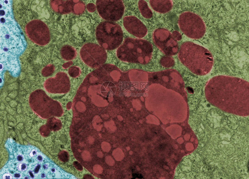 假彩色透射电子显微镜TEM显微照片显示许多溶酶体图片