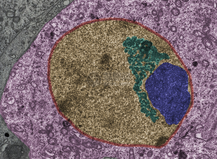 的假彩色透射电子显微镜TEM显微照片核棕色图片