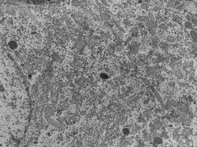 神经细胞体的传输电子显微镜TEM显微图图片