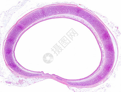 气管的横截面背景图片