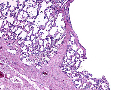 人类精囊粘膜表面非常折叠看起来像腺体的空间实际上是与管腔相通的粘膜的内折上皮呈假复层柱状背景图片