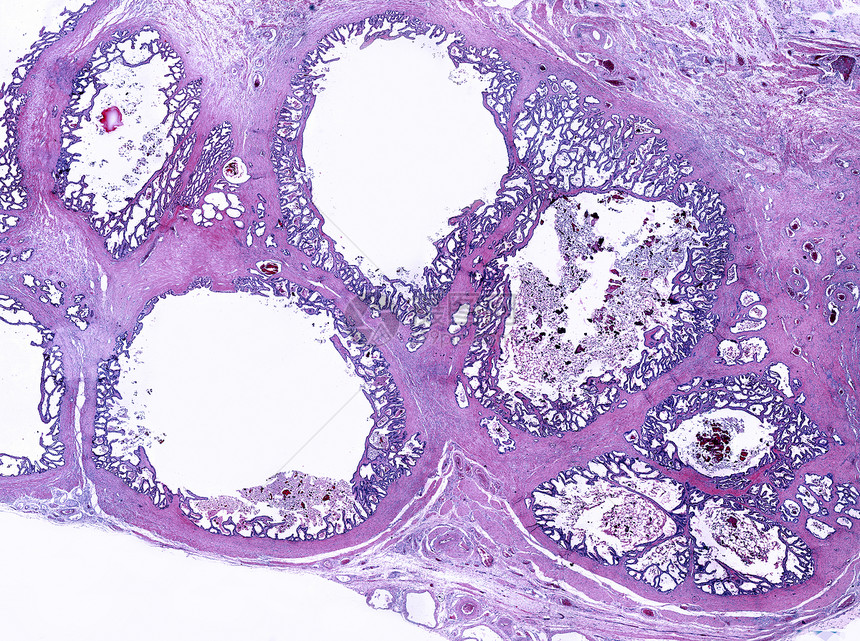 人类精囊的低倍显微照片每个囊泡由一个折叠并盘绕在自身上的单管组成粘膜显示出许多不规则和复杂的褶皱图片