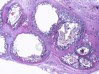 人类精囊的低倍显微照片每个囊泡由一个折叠并盘绕在自身上的单管组成粘膜显示出许多不规则和复杂的褶皱背景图片