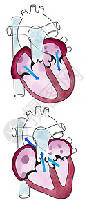 心脏心室心肌人体解背景图片