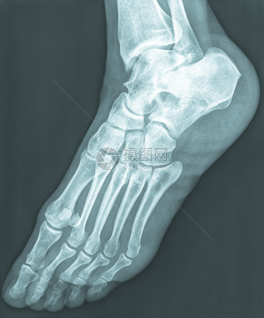 人体女脚骨X图片