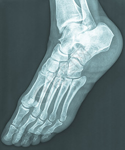 人体女脚骨X图片