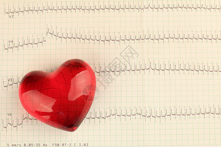印刷的ECG图片