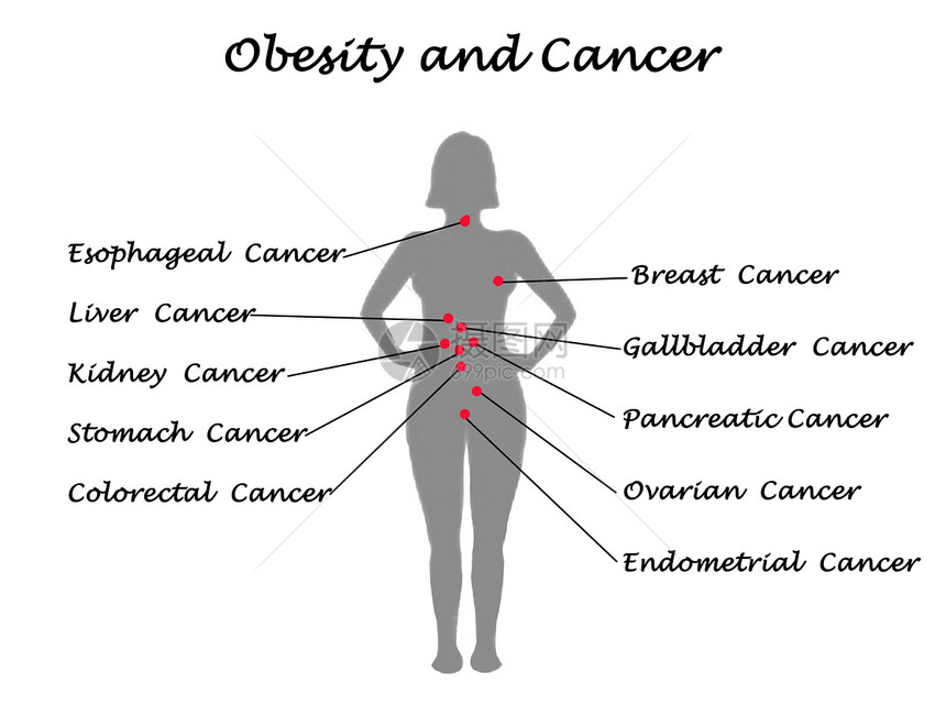 肥胖作为许多癌图片
