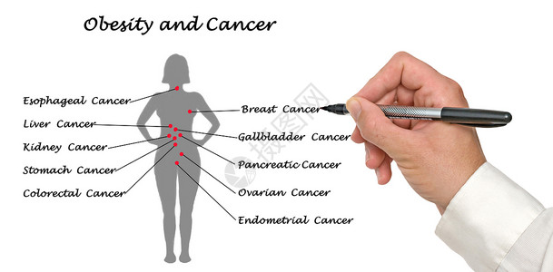 肥胖与癌症之间的联系图片